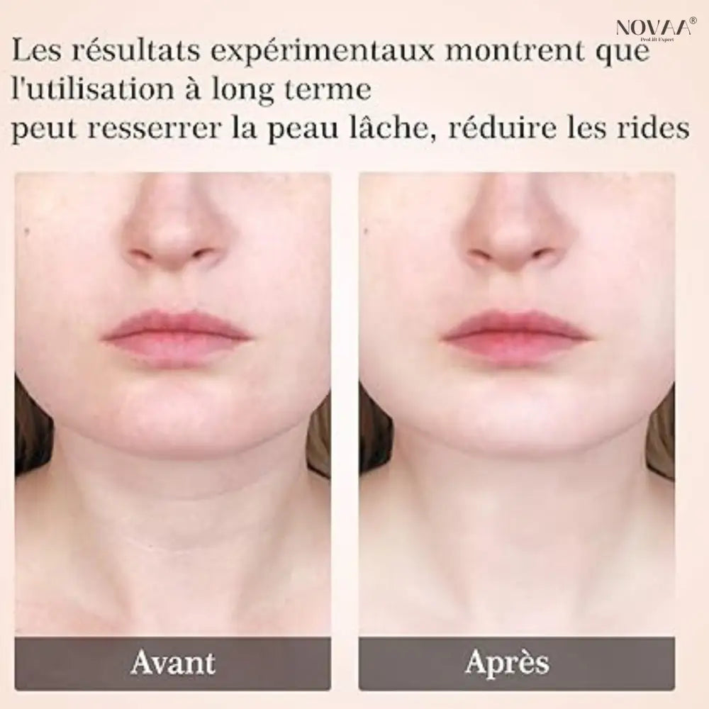 Sculpteur Facial – Anti-Rides & Lift Visage | Novaa® Pro Lift Expert