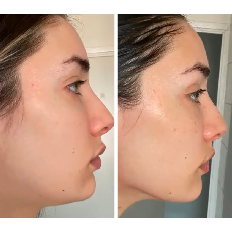 Sculpteur Facial – Anti-Rides & Lift Visage | Novaa® Pro Lift Expert